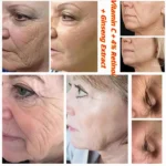 Soothing Moisturizing Improve Brightening Facial Snail Mucin Rice Cream 4% Retinol Serum Eye Cream Seoul 1988 Korea Skincare Set - Image 4